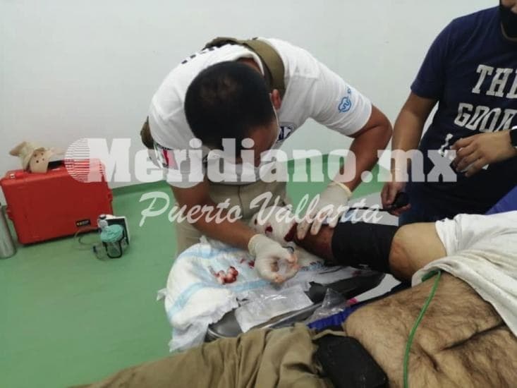 Vecino de talpa de allende…  ¡trabajando se  amputó una mano!