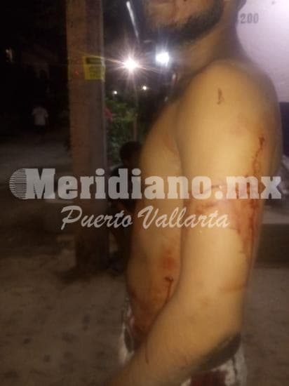 En la guadalupe victoria…  ¡navajeado en una riña!