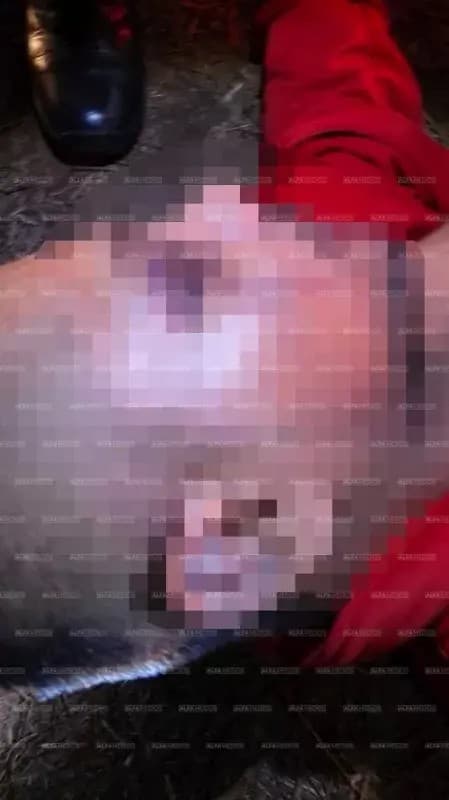 Policia municipal salva la vida de un hombre