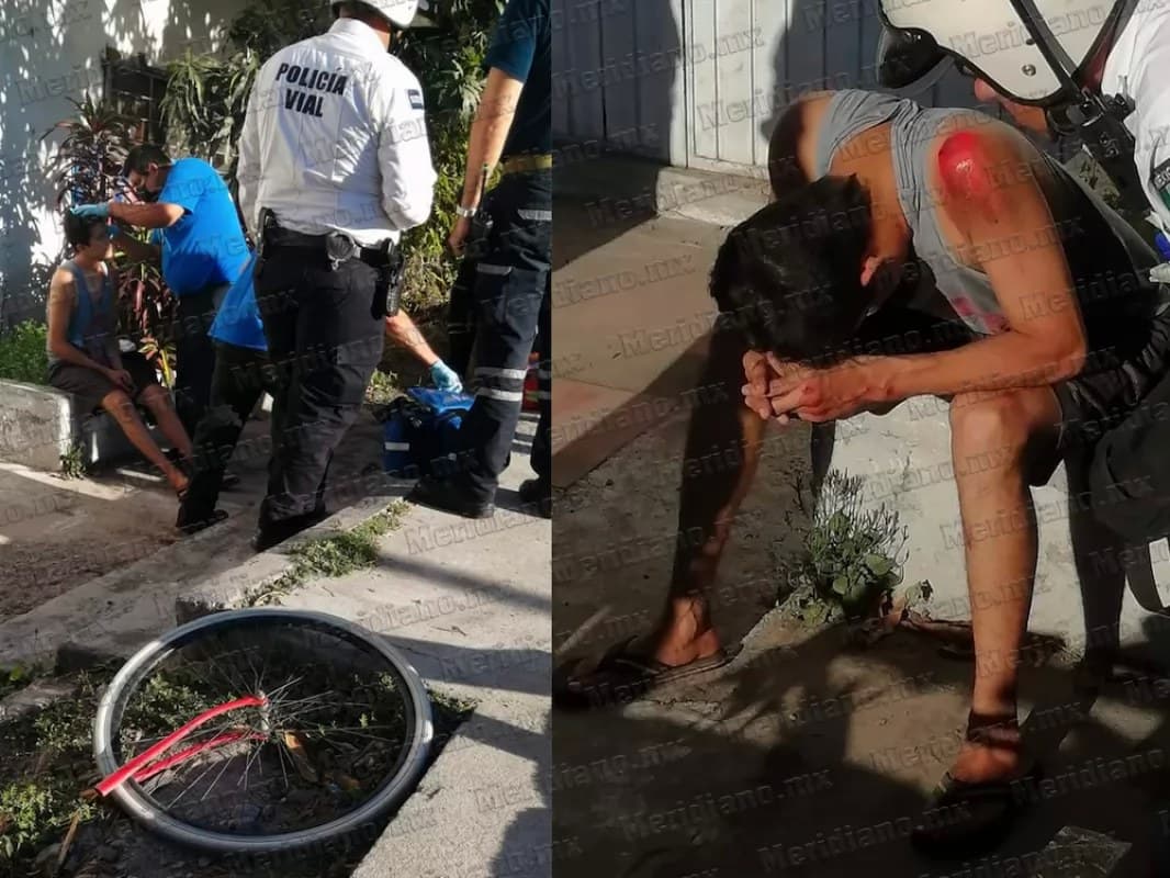 Bici se partió en dos y casi se queda sin dientes