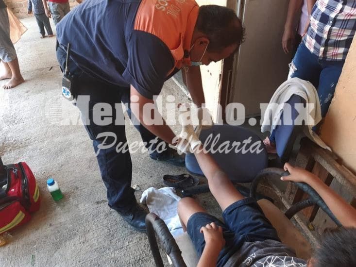 Es vecinito de ixtapa… ¡niño se enterro varilla oxidada!