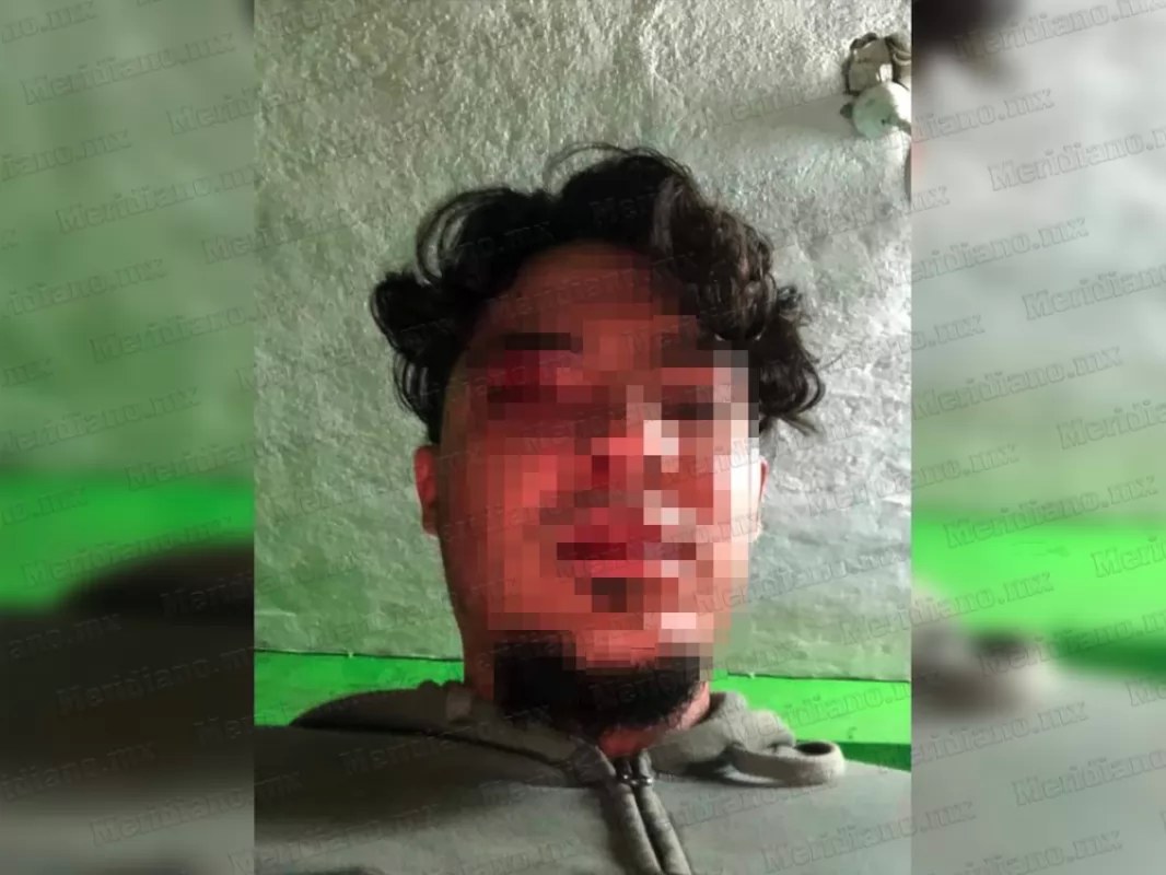 ¡lo golpearon por robarle la moto!