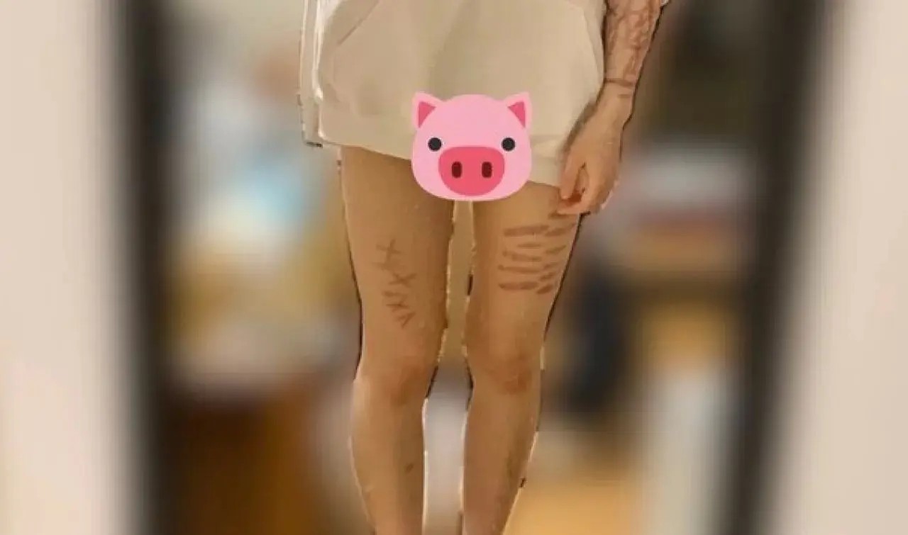 Aparece presunta canibal en twitter; documenta como se \"auto devora\"