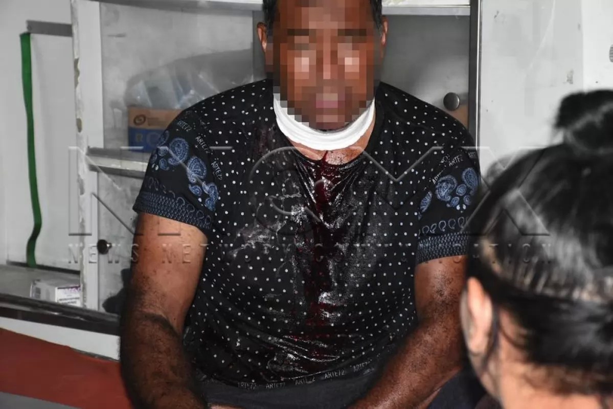 Lesionado e incendiado en la colonia primero de mayo