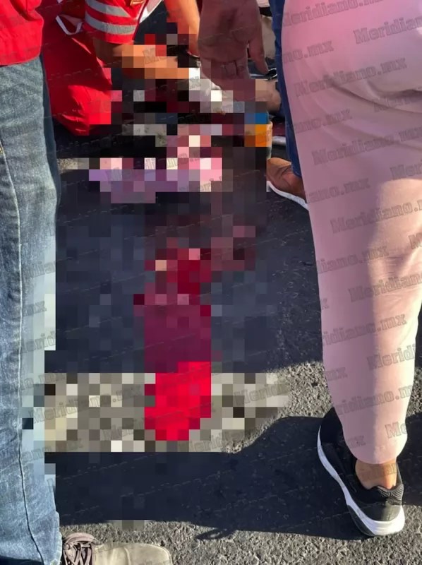 Amputa a motociclista al pasarse la luz roja del semaforo