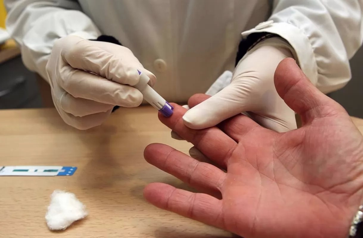 Ofrecerán pruebas gratuitas de VIH en Tepic