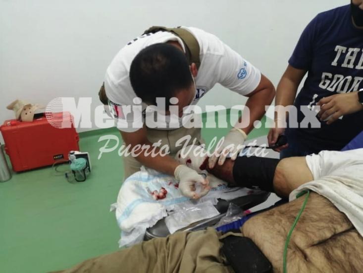 Vecino de talpa de allende… ¡trabajando se amputó una mano!