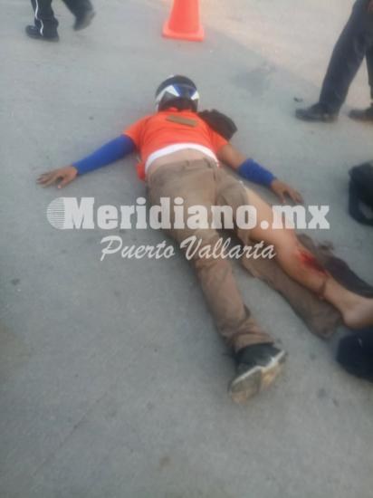 Sobre la carretera 544… ¡motociclista fracturado!