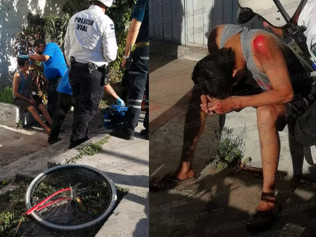 Bici se partió en dos y casi se queda sin dientes