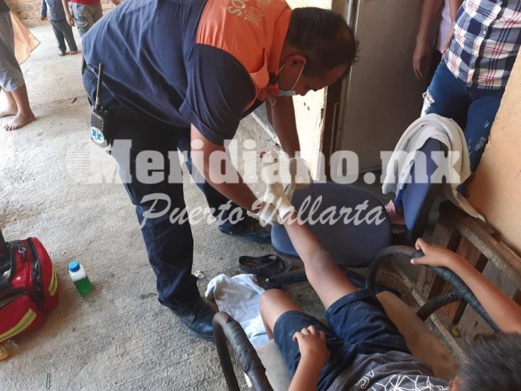 Es vecinito de ixtapa… ¡niño se enterro varilla oxidada!